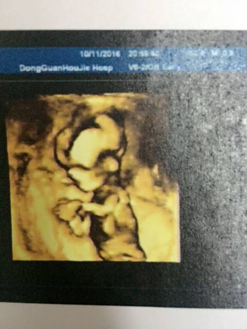 怀孕15周_现在不是说医生不能帮看男女吗?怎么看到圈里好多人_宝宝树