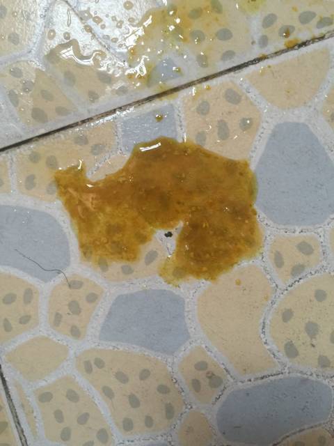 宝宝拉肚子怎么?_宝宝四个月了拉肚子怎么办