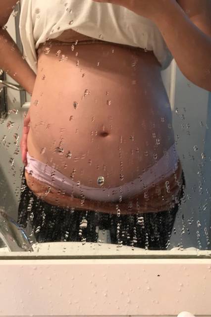 怀孕6个月，肚子大吗?_大宝是儿子，二宝希望是个女孩，25周_宝宝树