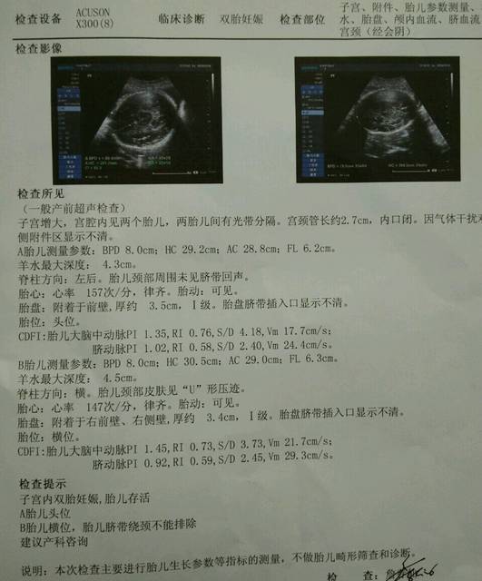 双宝32+2周B超单_双胞胎32+2周B超求鉴定, 帮
