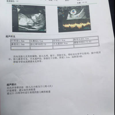 育儿问答 怀孕期 今天12周,做nt检查,nt值4.8mm,其他都正常!
