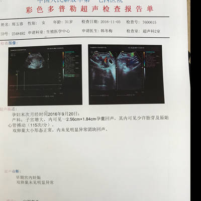 医生挫伤探索,当时肋骨让做b超打架脾有没有破裂,然后看看大自然的教学设计图片