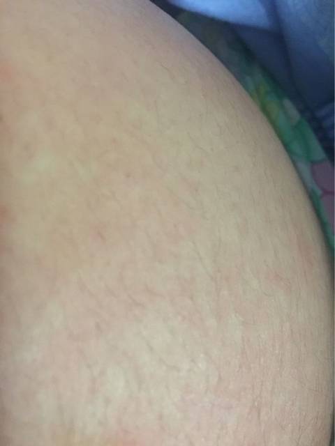 肚子痒,难受_29周了,肚子痒的难受,痒得睡不着