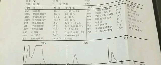 双肾系统分离是男宝?!有经验的宝妈来说说