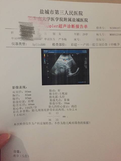 宝宝脐带绕颈两周怎么办?_怀孕33周了,今天查