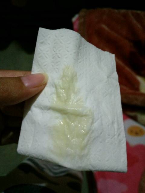 这是分泌物还是什么_这几天一直都流这个要么就内裤湿了一片,请_宝宝树