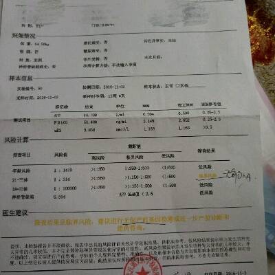 唐筛结果21三体临介风险这项没过,麻烦大家帮忙看看谢谢