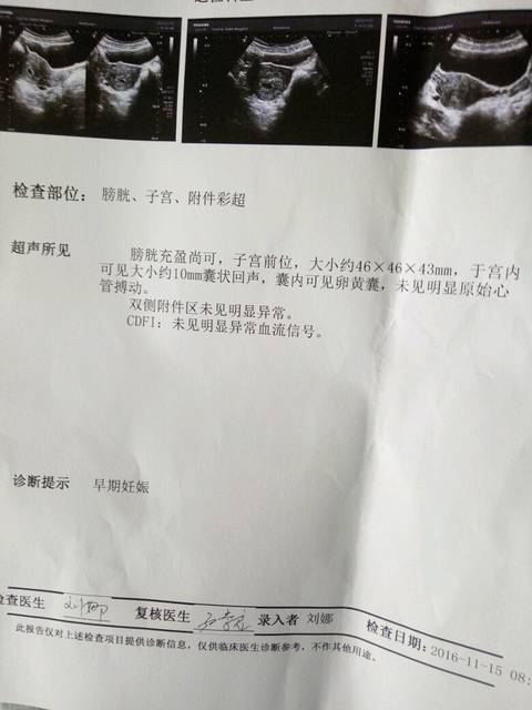 怀孕6周 今天去医院检查 bc没有测到胎心胎芽