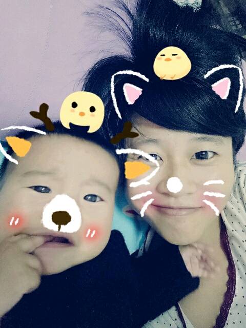 个位宝妈的宝宝们有腿纹不对称的吗?急_我家