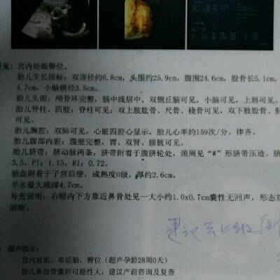 孕28周检查疑是鼻泪管囊肿,不知道严重不,能自己消失吗?