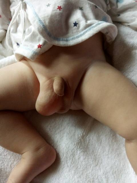 大家帮看看_宝宝的睾丸一大一小怎么回事