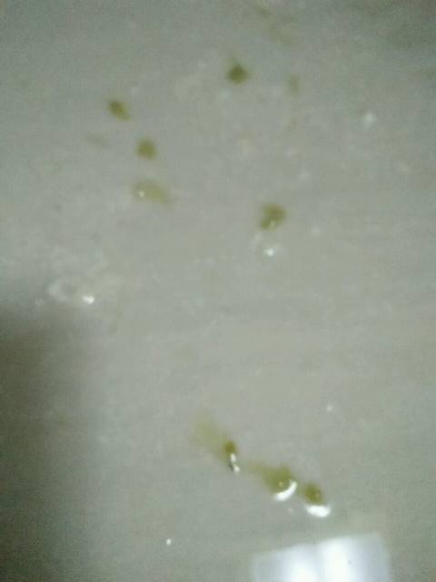 刚出生二十天的宝宝吐奶时带有绿色跟谈一样的