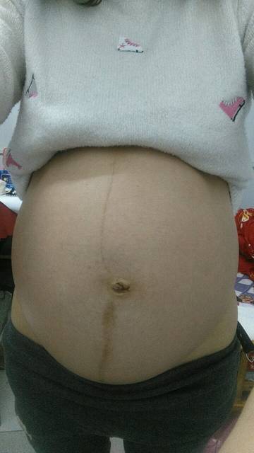 医生说宝宝头小个子高