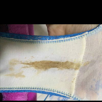 你好,我怀孕27周了,昨晚和今天都发现内裤上有