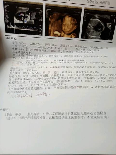 急急(胎儿超声心动图),哪个医院能做要预约吗?