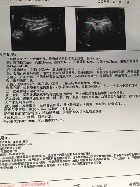 胎盘2级了,啥时候到3级,会早产吗?_今天才发现