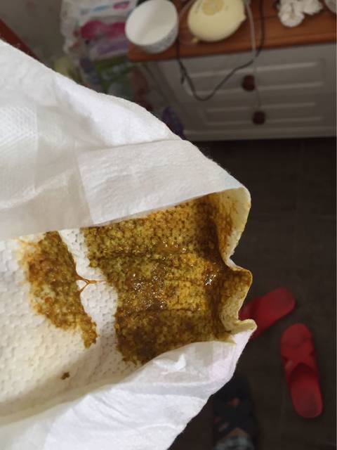 新生儿大便_我家宝宝出生第四天,拉出来的大便