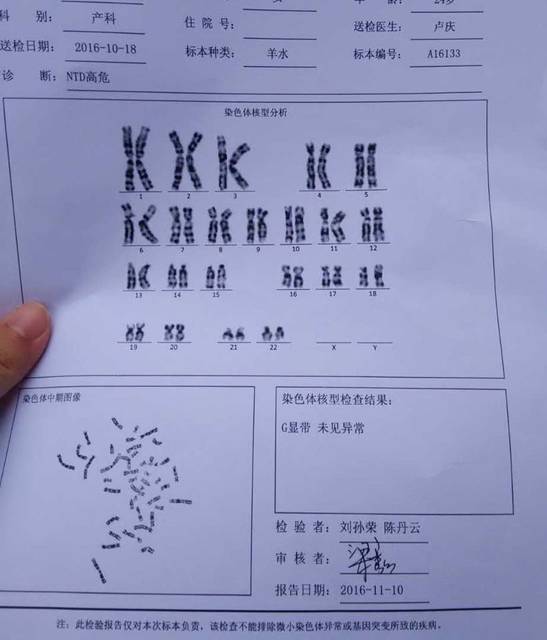 愿宝宝健健康康!还愿!_唐氏高危的时候医生说