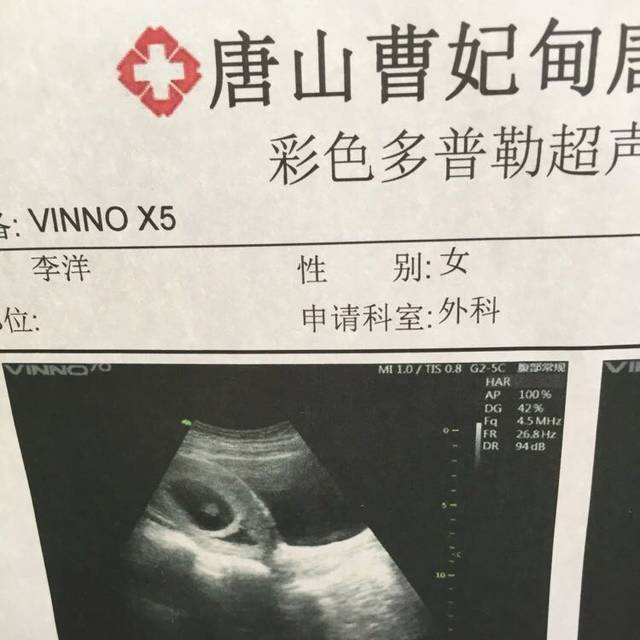 怀孕初期,空腔积液怎么办?_我怀孕54天了,超声