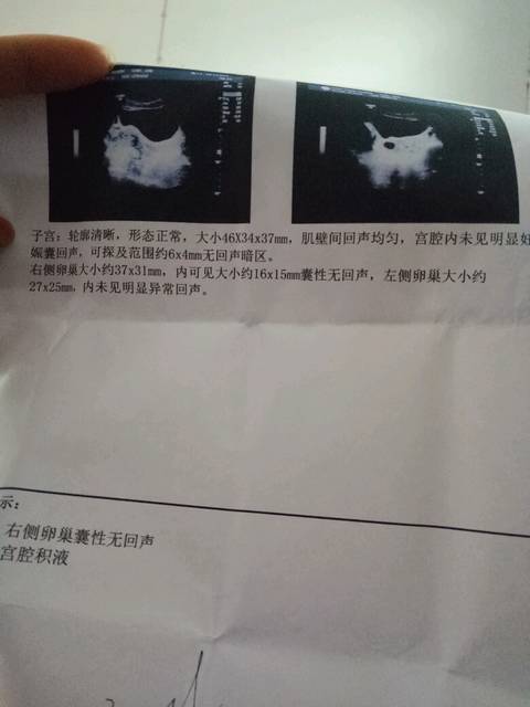 早孕_停经43天,验血孕酮6.2HCG1022.21,彩超