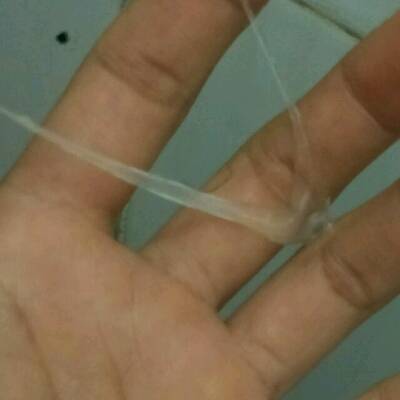 早上测到强阳了,上厕所有这一坨出来这是白带拉丝么?
