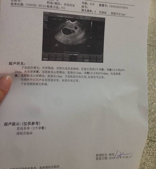 试管双胎 孕囊大小差别很大 怎么办