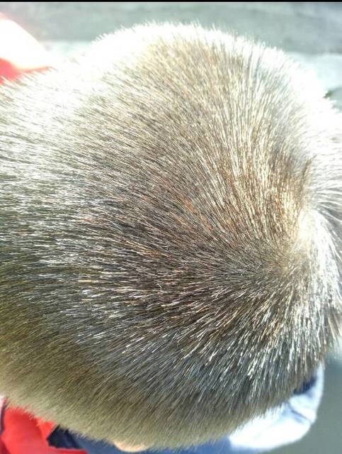 宝宝黄头发怎么回事?_我家宝宝马上两岁了,有