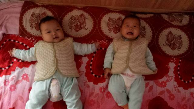 真心有没有掉发的_女生当妈a真心,生这两宝在医产后有里面硬胸块图片