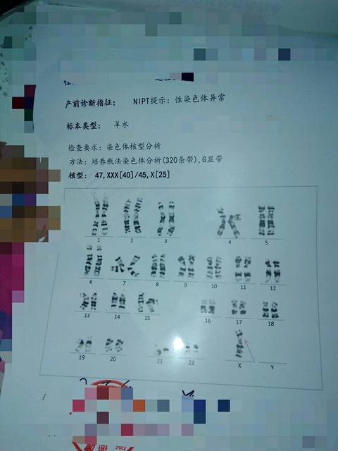 羊水穿刺_羊水穿刺结果说异常我该怎么办