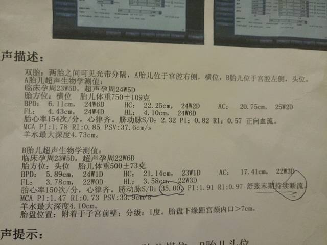 双胎选择性胎儿生长受限_怀孕24周 ,其中大宝