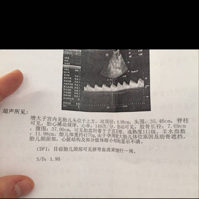 盘成熟度已经三级,比实际孕周大两周,胎位臀位