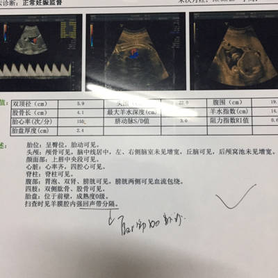 孕24周,医院做彩超显示羊膜强回声区有隔离带
