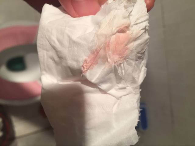 怀孕3个月,小便后,手纸上带点粉红色,为什么啊