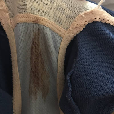 你好,我38了,怀孕3周,这2天3次排出褐色的血和分泌物,这是第一次排的,后面2次少些,肚子没有很疼,只是有时候有点不舒服,怎么回事啊?严重吗?_育儿问答_宝宝树