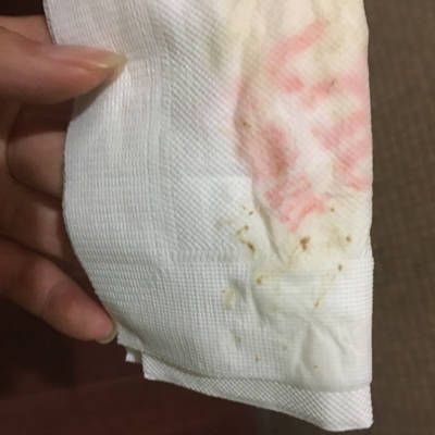 怀孕四个多月,白带增多,也不觉得痒,就是下面一直是湿的,刚换的内裤第