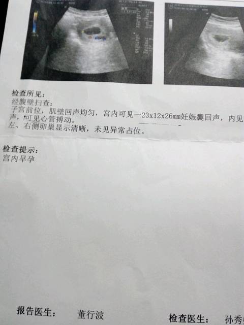 有没有流褐色血的宝妈_6周+4天,这两天老是流