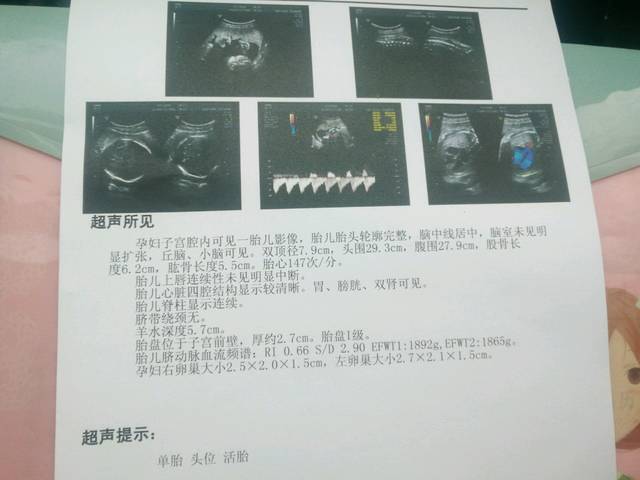 32周小排畸顺利通过。_等了一下午我进去5分