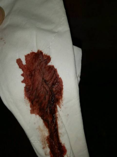 左下腹疼_十一月二十五号来的月经!一月九号又