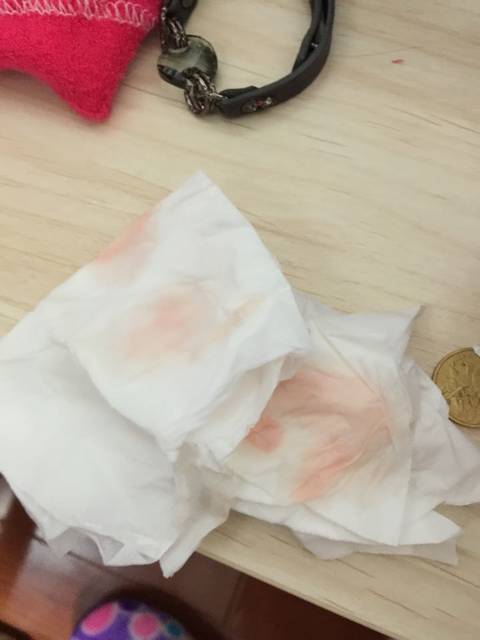 1.11预产期,见红了,但肚子不痛宫口未开,多久才