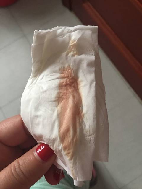 怀孕初期有褐色分泌物_末次月经11月27号,1月