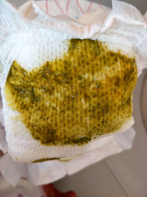 宝宝大便偏黄绿色有粘液,偶尔有血点,有一样的