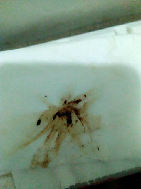 怀孕三周出现咖啡色分泌物怎么回事_怀孕三周