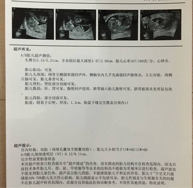 双胞胎NT通过_昨天第一次产检,彩超的时候花