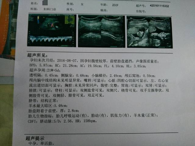 协和大排畸顺利通过_想问问大家小排畸是查什