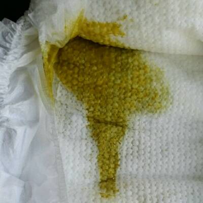 宝宝五个月母乳喂养,最近几天总拉绿色稀便,一