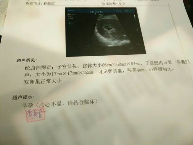 胎心不显,心管搏动无_怀孕50+没有胎心,前两天