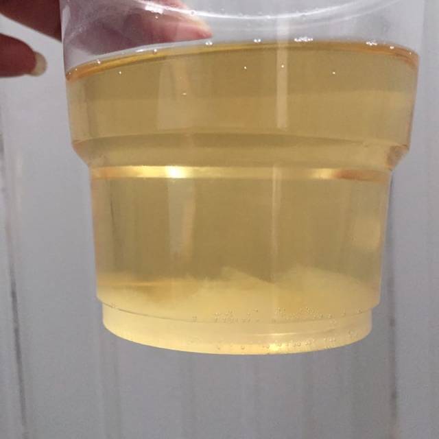 37周生啦!附症状!_如愿在年前生了猴宝宝!三十