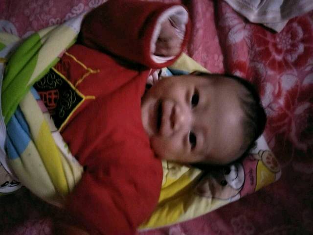 宝宝两个多月,耳朵后面长出凸起不对称的骨头