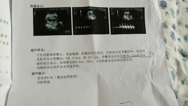 怀孕快三个月了宫腔积液怎么办?_过年初二回