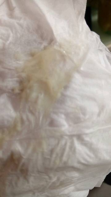 急!有图慎入_孕后期白带都是一坨一坨的,特别